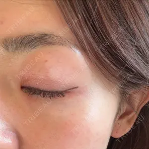 Natural Skin Clinic 笹塚院口コミ