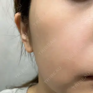 イデア美容皮膚科クリニック 柏院口コミ