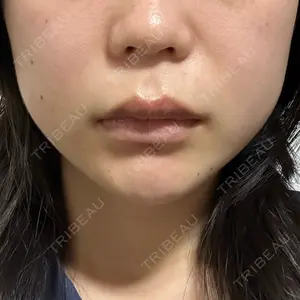 湘南美容クリニック 渋谷院口コミ