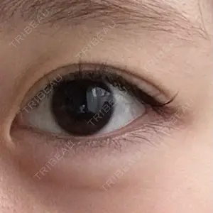 HAAB CLINIC 池袋院口コミ