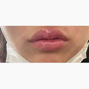 ルラ美容クリニック 渋谷本院口コミ