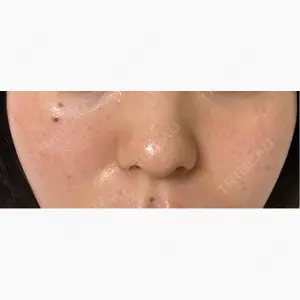 MAe Clinic 大阪院口コミ
