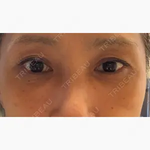 アリエル美容クリニック 大宮院口コミ