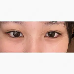 エターナル美容クリニック口コミ
