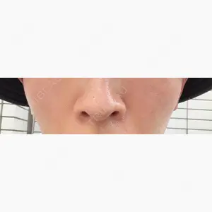 KARIS beauty clinic口コミ