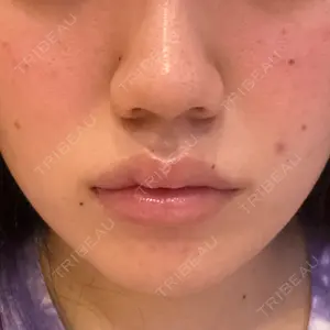 HAAB BEAUTY CLINIC 名古屋院口コミ