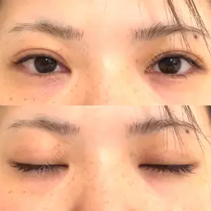 BELINDA CLINIC（ベリンダクリニック）新宿院口コミ