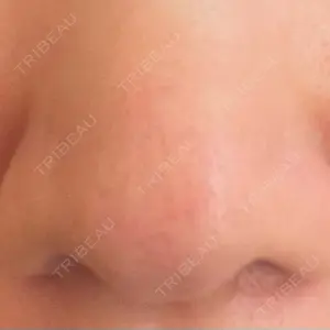 PRO CLINIC プロクリニック 銀座院口コミ