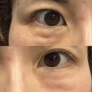 TCB東京中央美容外科 福島院口コミ