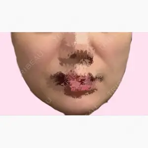 4Dクリニック口コミ