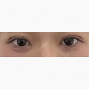 Brandnew Beauty Clinic口コミ