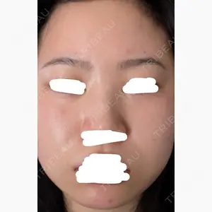 KARIS beauty clinic口コミ