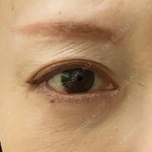 ネビュラクリニック 広島院口コミ