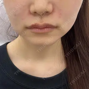 ルラ美容クリニック 大阪本院口コミ
