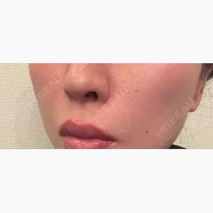 美容皮膚科ティファクリニック 新宿東口口コミ