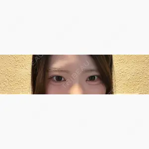 アリエル美容クリニック 郡山院口コミ