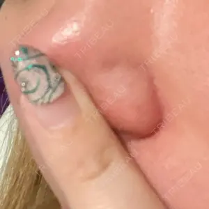 KM新宿クリニック口コミ