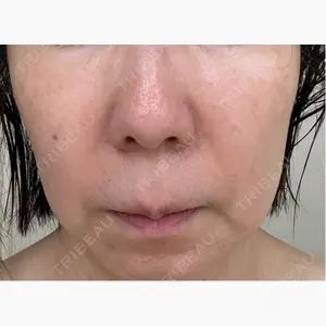 APスキンクリニック銀座口コミ