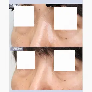 聖心美容クリニック 六本木院口コミ