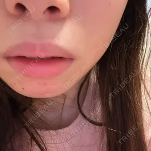 湘南美容クリニック 新橋銀座口院口コミ