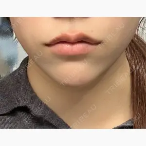 L‘amour clinic Tokyo【ラムールクリニック東京】口コミ
