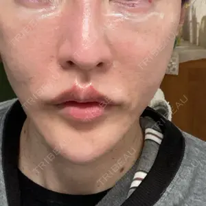 博多美容外科/美容皮膚科 ビラビューティークリニック口コミ