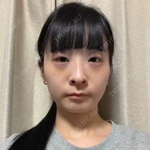 小倉美容外科ネビュラクリニック口コミ