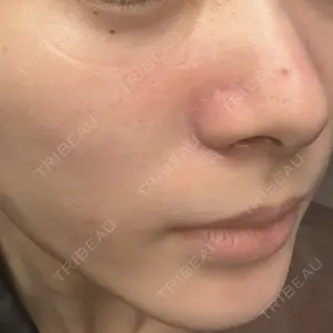 新宿Ladies&Gentlemen美容クリニック口コミ