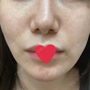 KARIS beauty clinic口コミ
