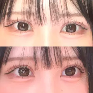 アリエル美容クリニック 大宮院口コミ