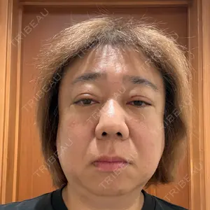 BIANCA銀座口コミ
