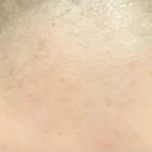 ルヴィクリニック イオンドーム前院口コミ