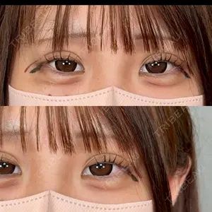 アリエル美容クリニック 大宮院口コミ