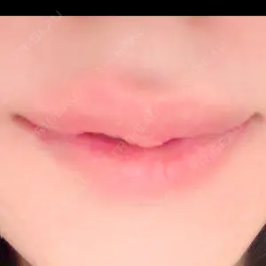 THE LINE CLINIC KICHIJOJI口コミ