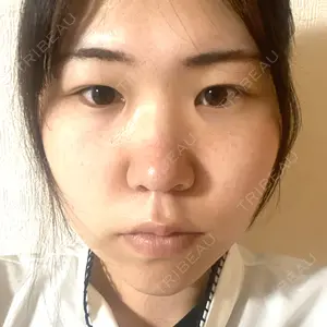 TCB東京中央美容外科 高崎院口コミ