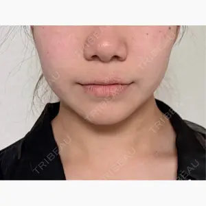 博多美容外科/美容皮膚科 ビラビューティークリニック口コミ