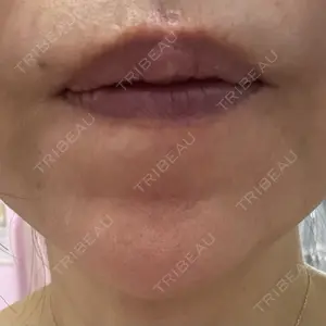 つだ美容外科クリニック口コミ