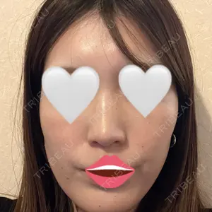 美容皮膚科ティファクリニック 新宿東口口コミ