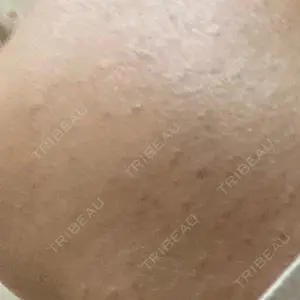 湘南美容クリニック 岡山院口コミ