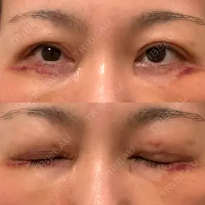 湘南美容クリニック 神戸三宮院口コミ