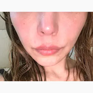 DAILY SKIN CLINIC 新宿院口コミ