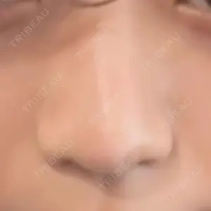 くさのたろうクリニック口コミ