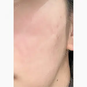 ルラ美容クリニック 札幌本院口コミ