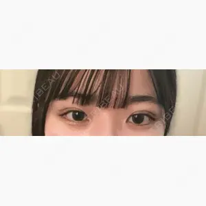 アリエル美容クリニック 水戸院口コミ