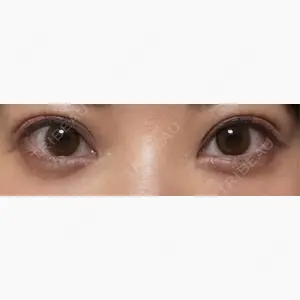 Brandnew Beauty Clinic口コミ