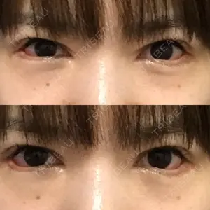 ジュエリー美容外科口コミ