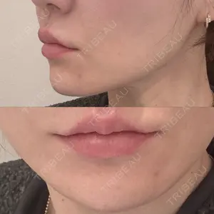DAILY SKIN CLINIC 心斎橋院口コミ