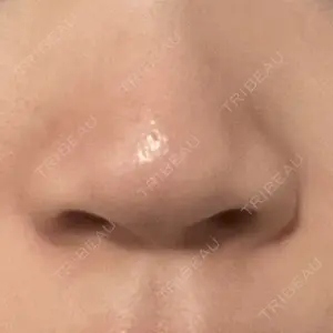 吉祥寺アイビークリニック口コミ