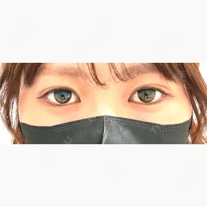 Brandnew Beauty Clinic口コミ