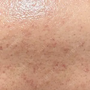 ライズワン美容皮膚科クリニック口コミ